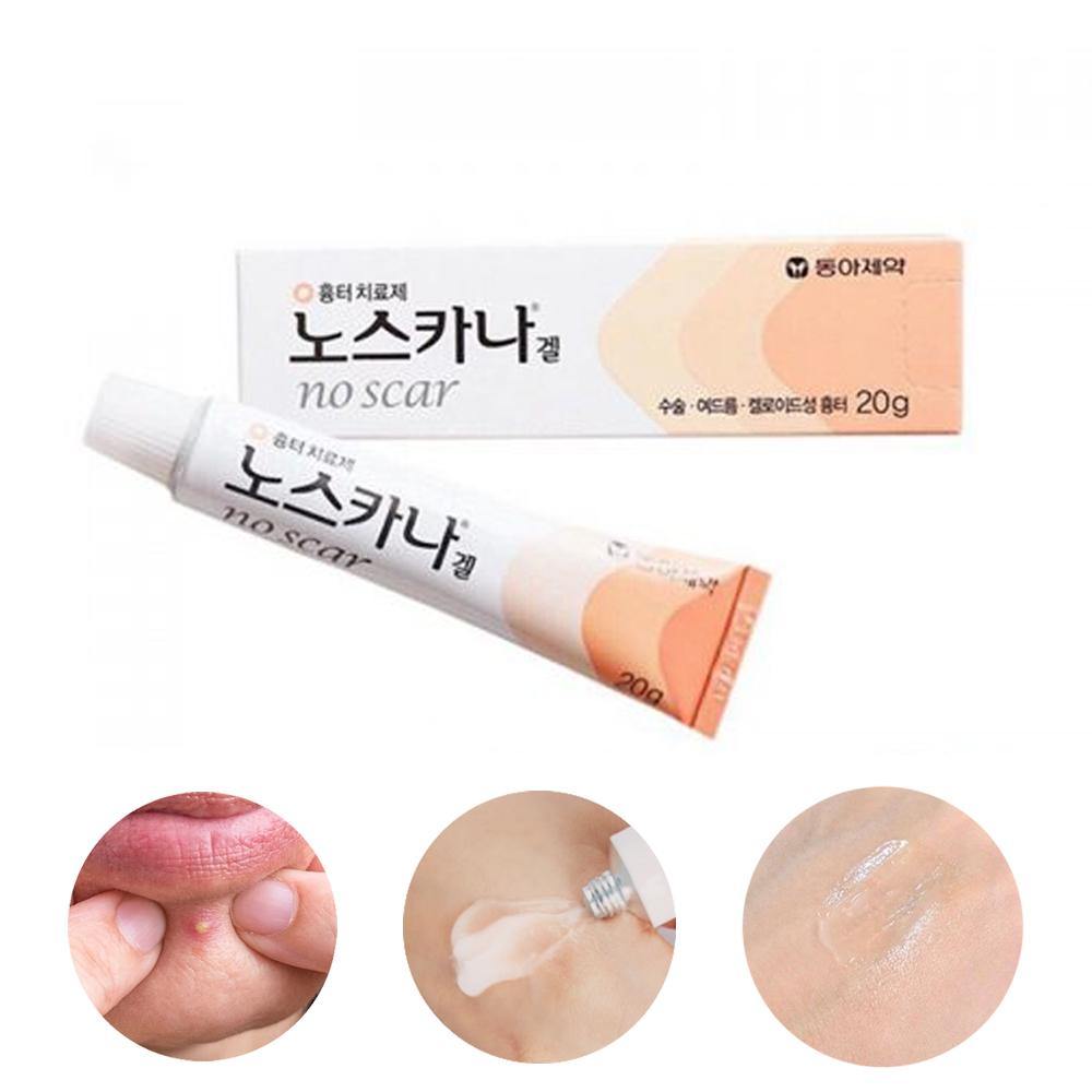 Dong-A Pharm Noscarna Acne Scars Removal Gels Face Facial Creams Large Size 20g Best help for getting rid of pimples Decent spot