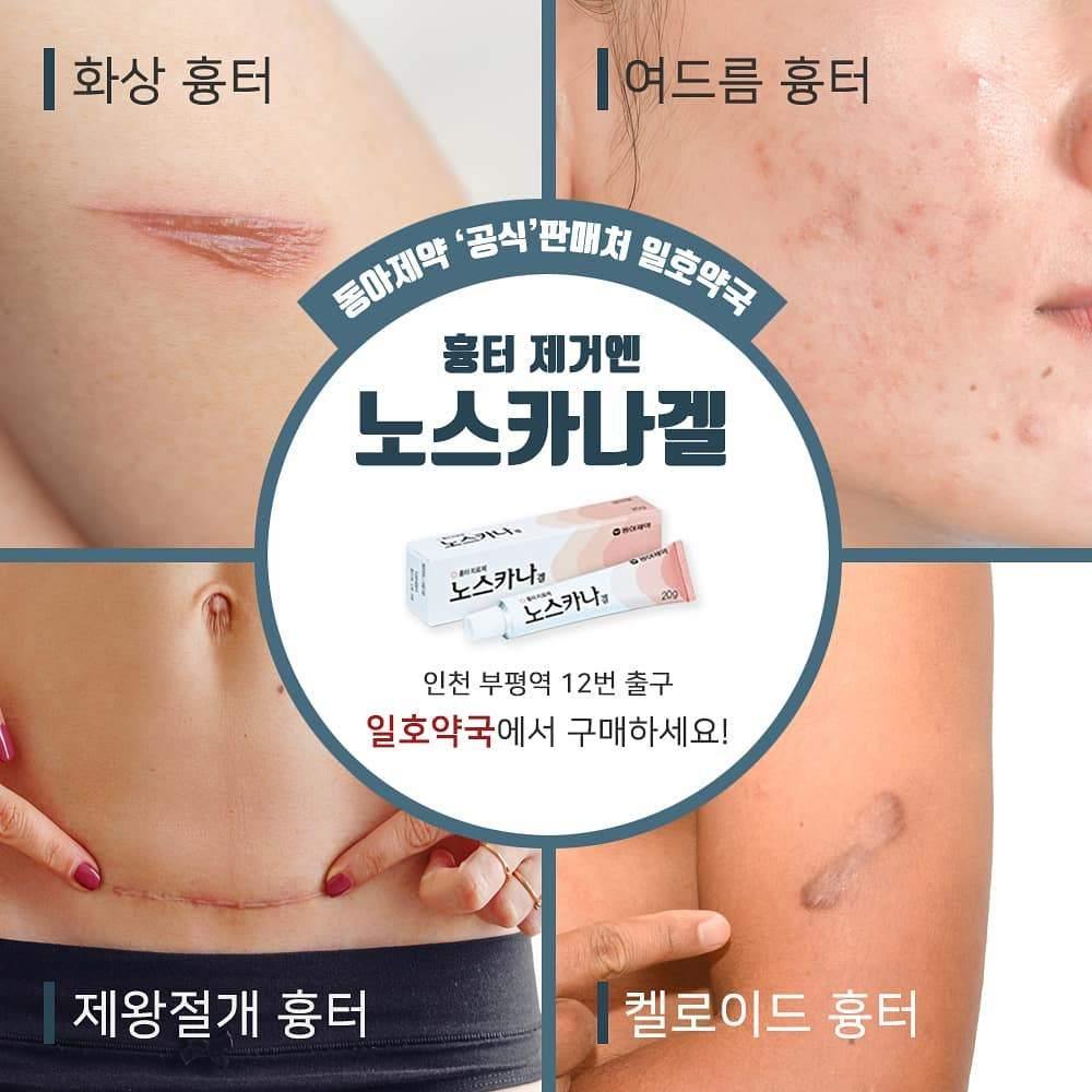 Dong-A Pharm Noscarna Acne Scars Removal Gels Face Facial Creams Large Size 20g Best help for getting rid of pimples Decent spot